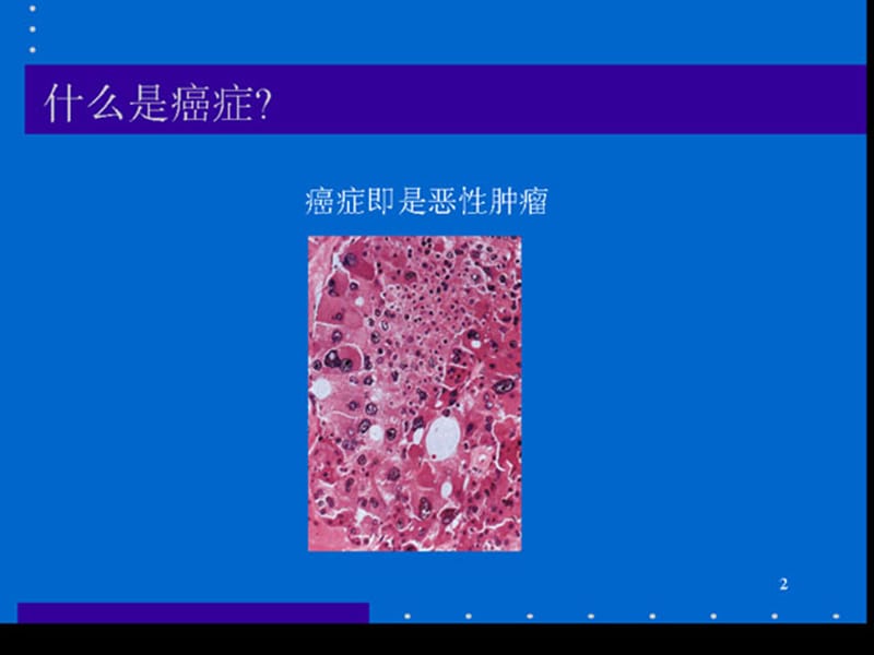 肿瘤学基本原则1.ppt_第2页