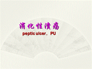 消化性溃疡3.ppt