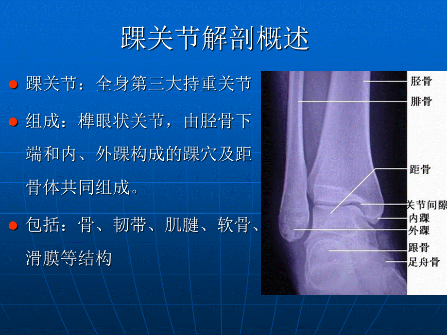 踝关节损伤磁共振诊断.ppt_第2页