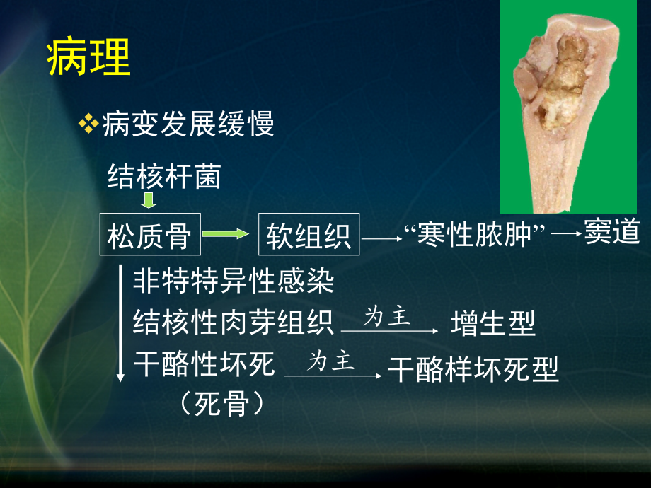 5_骨关节结核.ppt_第2页