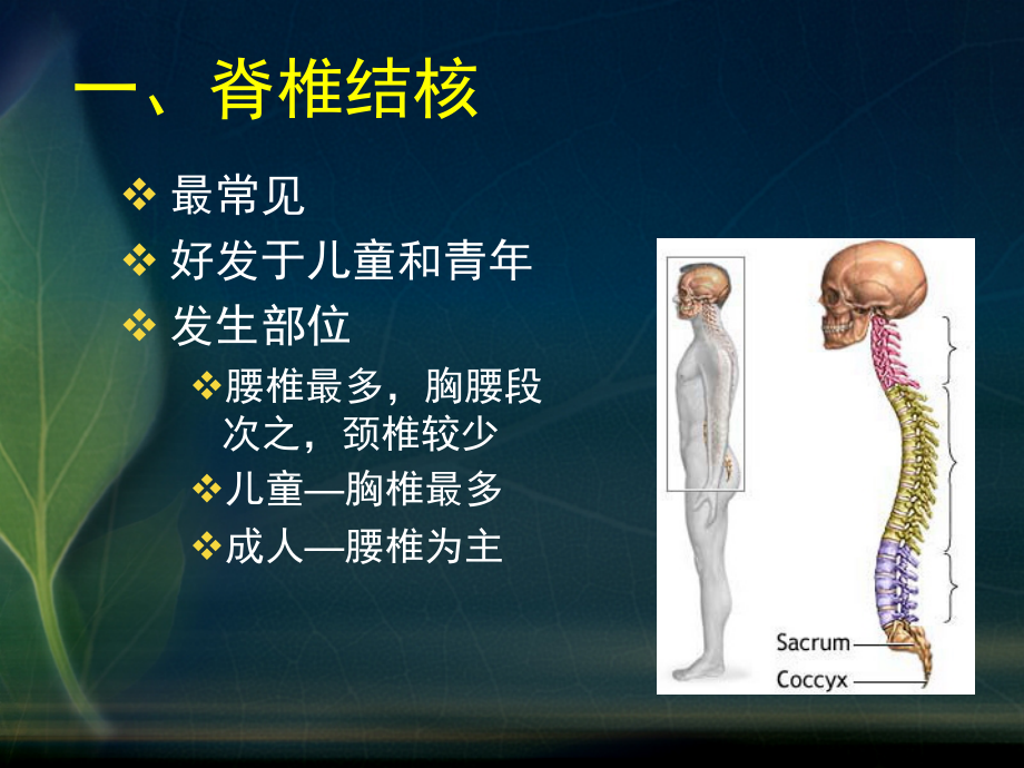 5_骨关节结核.ppt_第3页