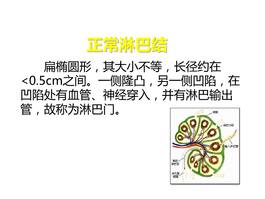 淋巴结超声教学.ppt_第2页