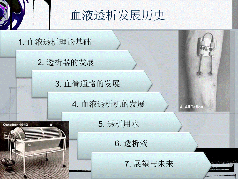 血透机发展历史.ppt_第2页