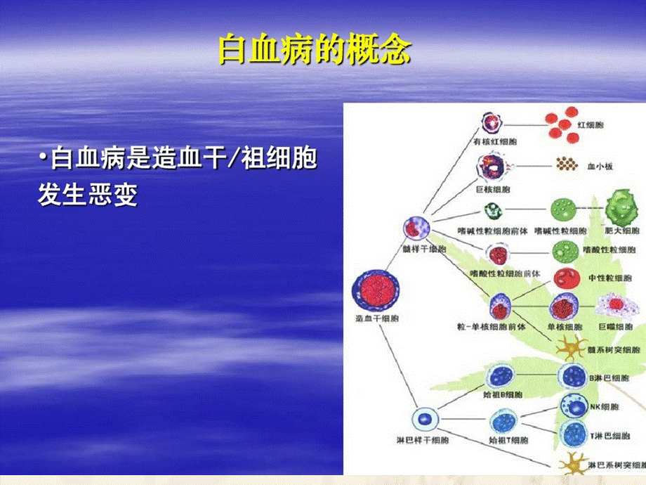 白血病的分型.ppt_第2页