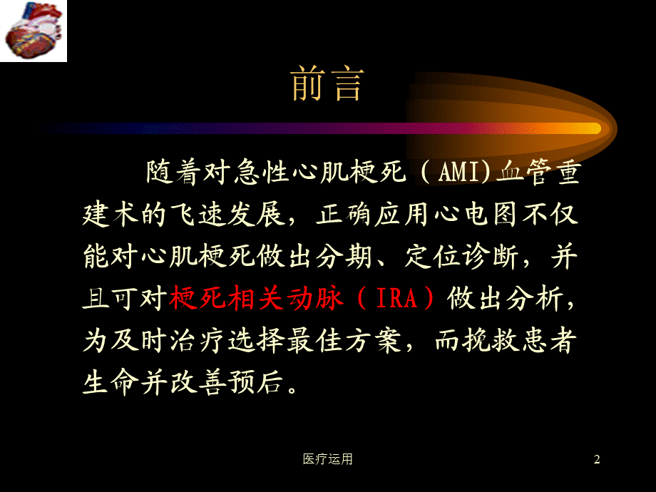 冠脉解剖与梗死相关血管心电图分析[医疗经验].ppt_第2页