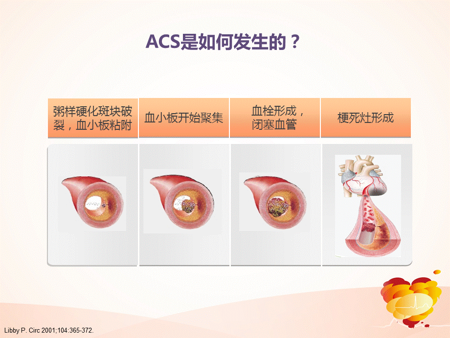 ACS患者治疗策略.ppt_第3页