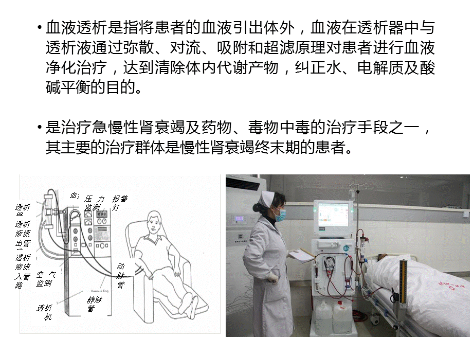 血液透析相关基础知识.ppt_第2页