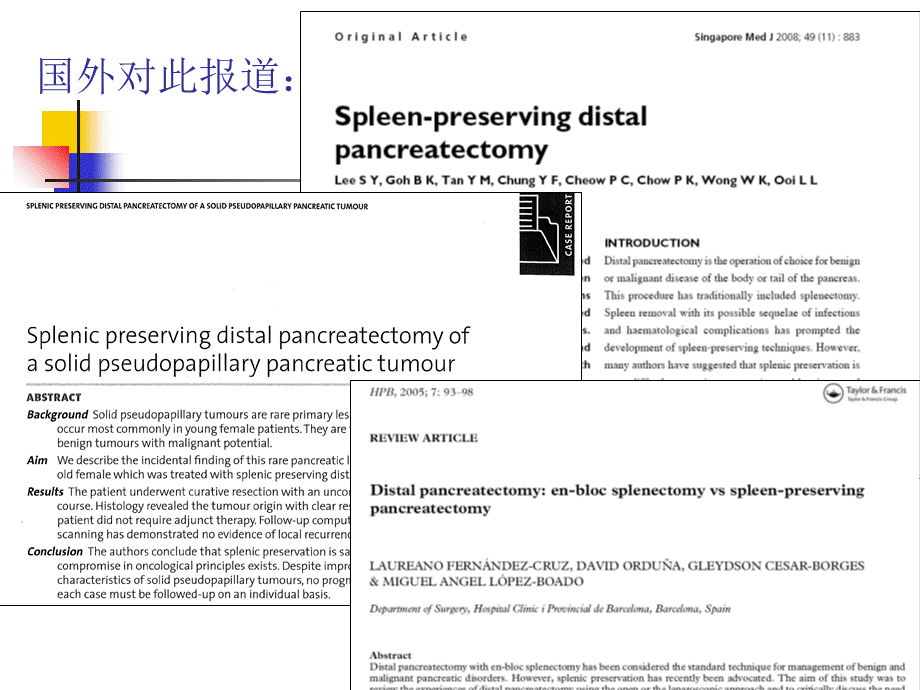 保留脾脏的胰体尾切除术－姜洪池课件.ppt_第3页