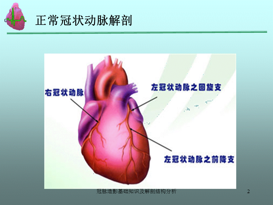 冠脉造影基础知识及解剖结构分析课件.ppt_第2页