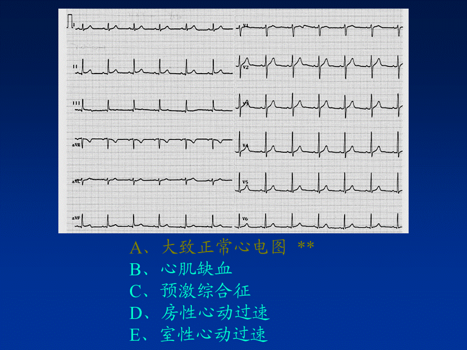 临床技能考试辅助检查结果判读PPT课件.ppt_第2页