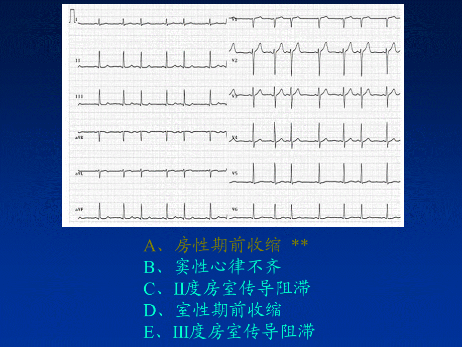 临床技能考试辅助检查结果判读PPT课件.ppt_第3页