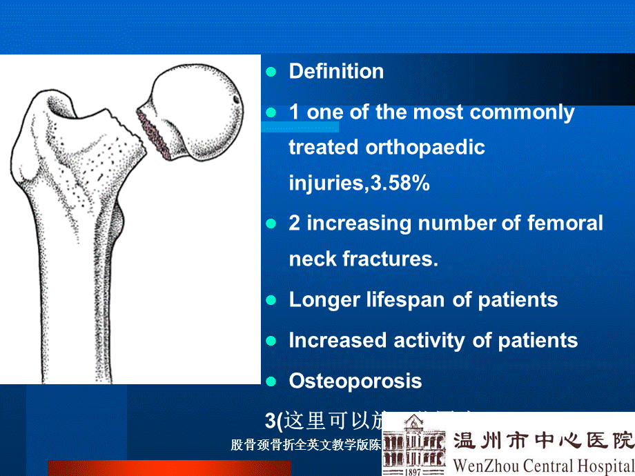 股骨颈骨折全英文教学版陈芒芒课件.ppt_第2页