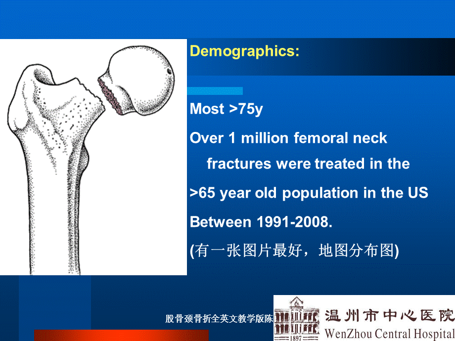 股骨颈骨折全英文教学版陈芒芒课件.ppt_第3页