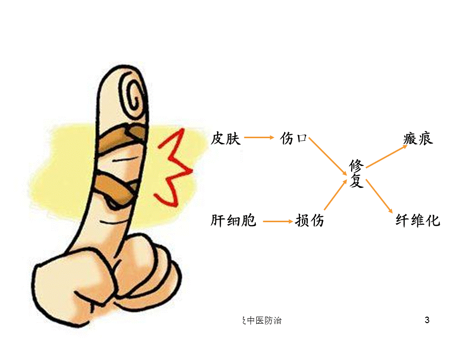 肝纤维化的危害及中医防治课件.ppt_第3页