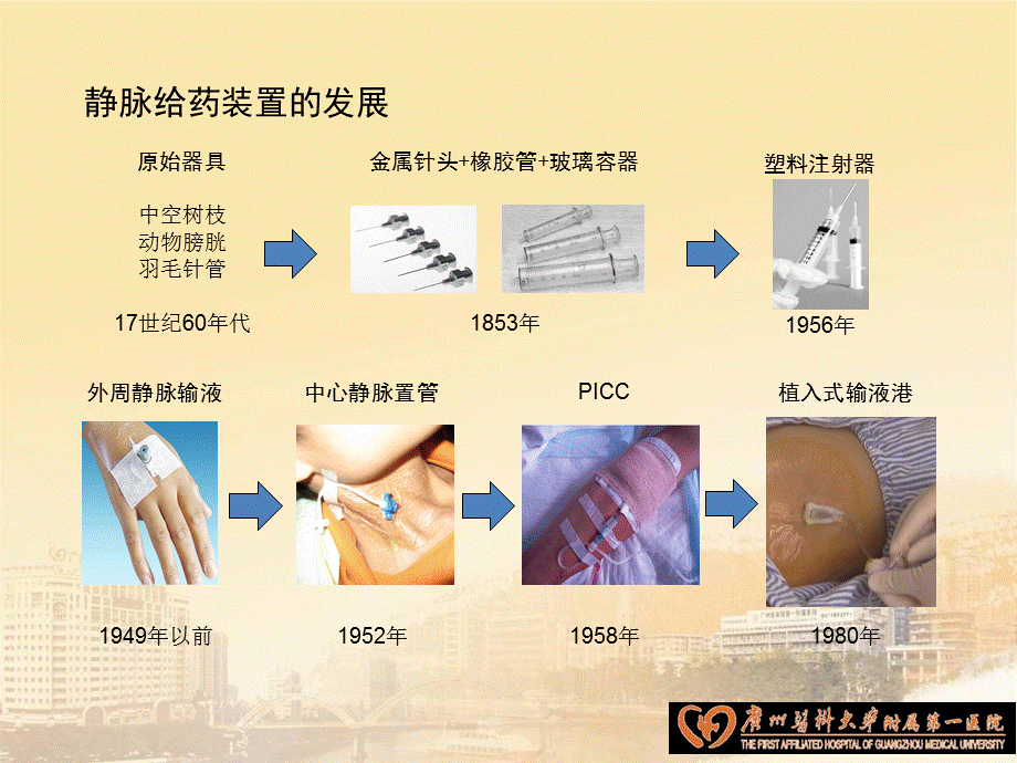 植入式静脉输液港的临床应用.pptx_第2页