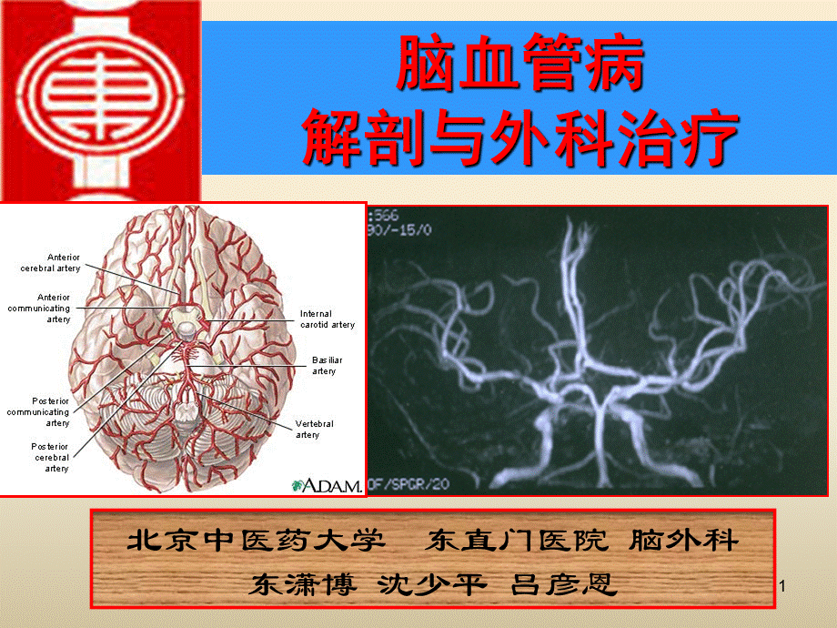 脑血管病解剖与外科治疗课件.ppt_第1页