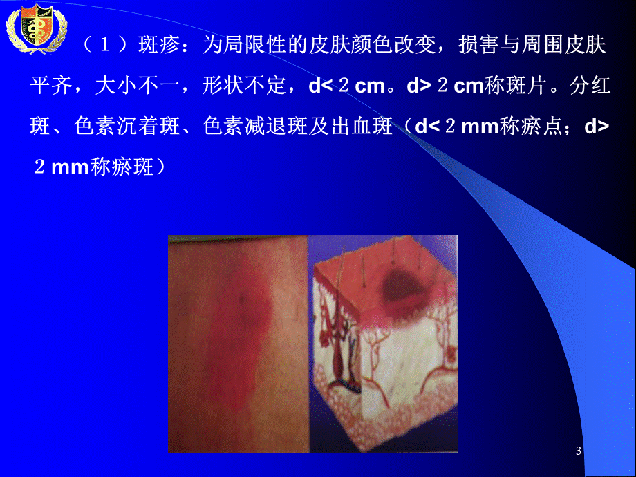 《皮肤性病学总论》演示PPT.ppt_第3页