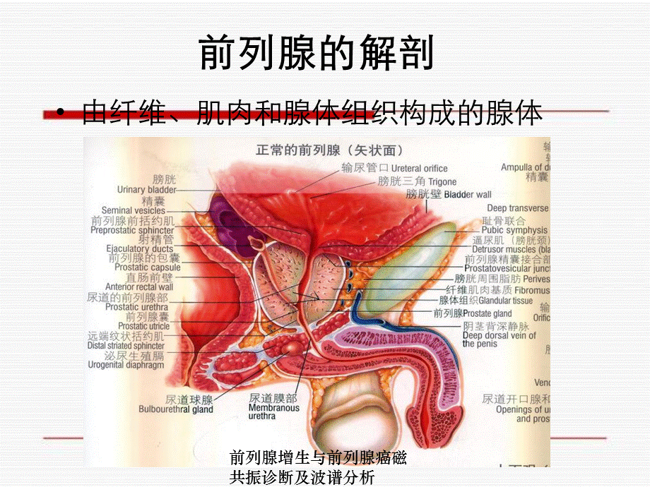 前列腺增生与前列腺癌磁共振诊断及波谱分析.ppt_第3页