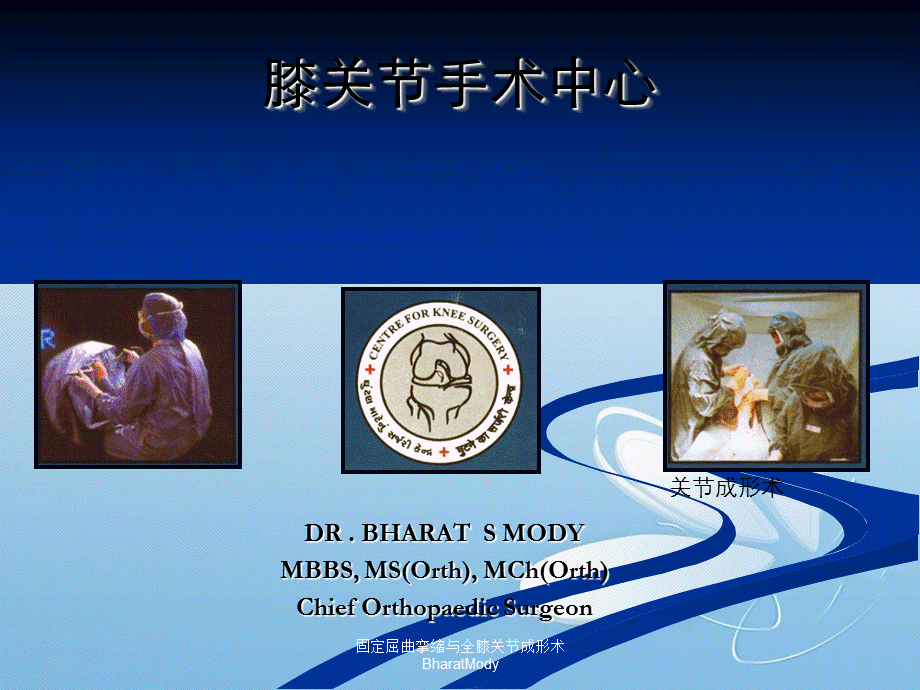 固定屈曲挛缩与全膝关节成形术BharatMody.ppt_第1页