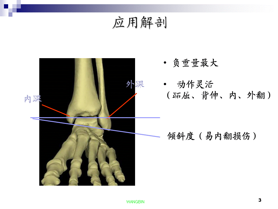 《踝骨折裴四才》.ppt_第3页