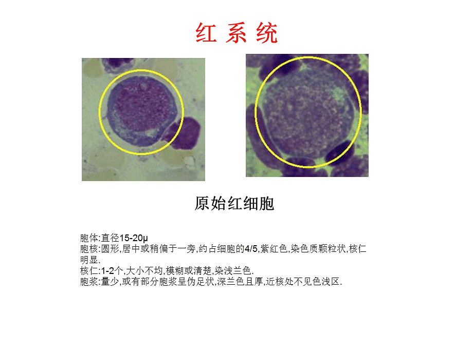 常见血液学图谱.ppt_第2页