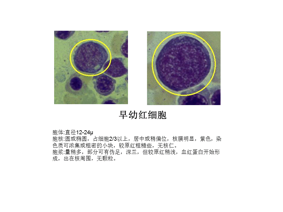 常见血液学图谱.ppt_第3页