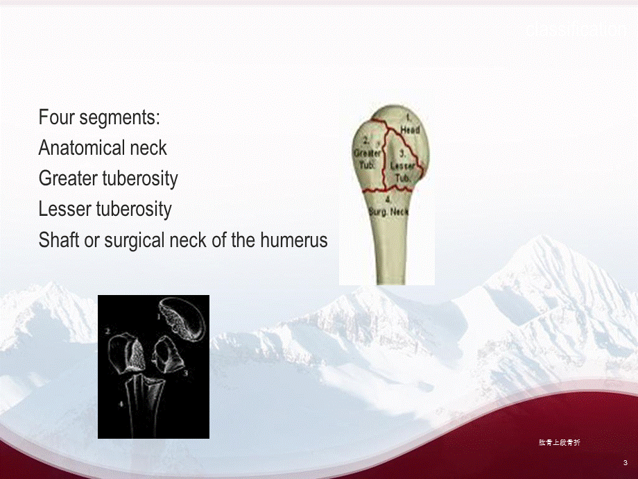 肱骨上段骨折课件.ppt_第3页