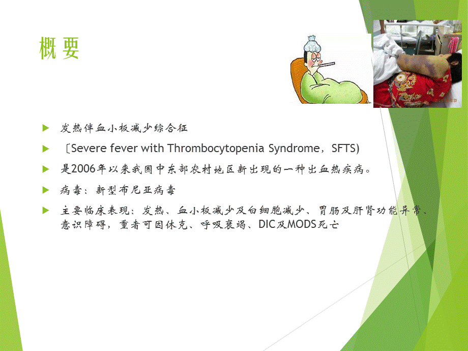 发热伴血小板减少及鉴别诊断PPT课件.pptx_第2页