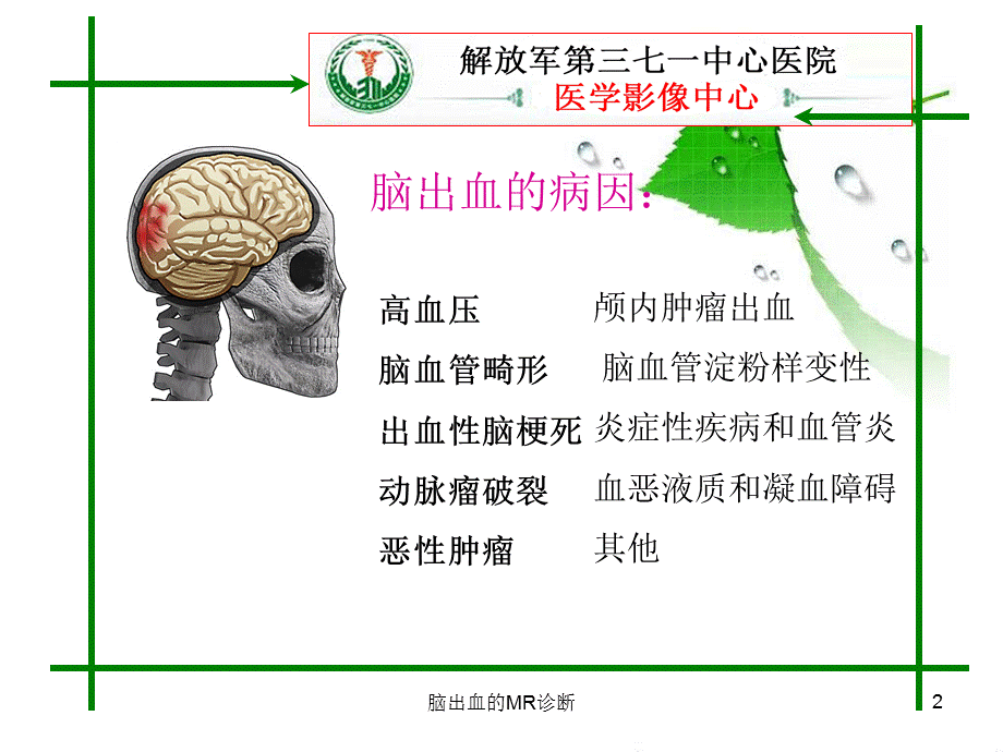 脑出血的MR诊断课件.ppt_第2页