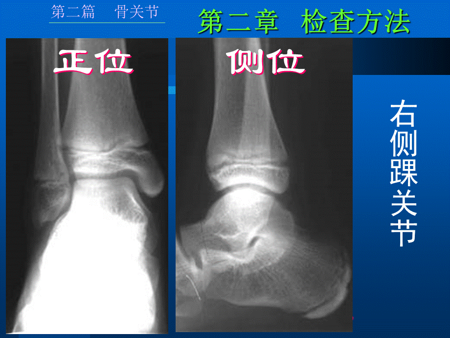 骨骼正常成人课件.ppt_第3页