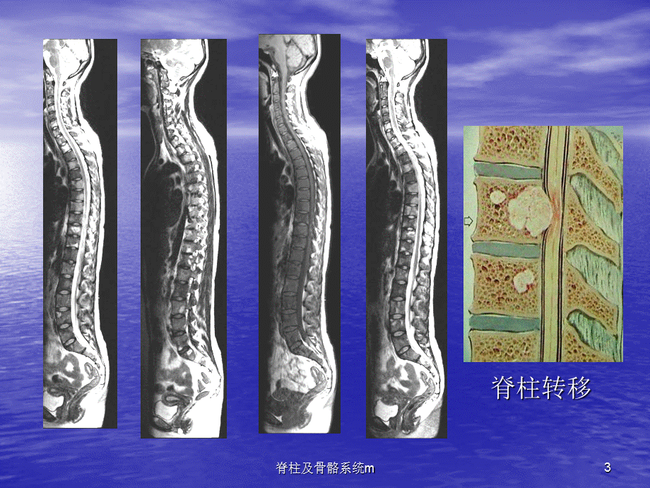 脊柱及骨骼系统m课件.ppt_第3页