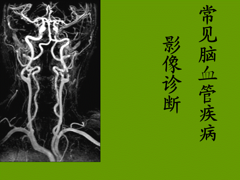 常见脑血管疾病的影像诊断PPT课件.ppt_第1页