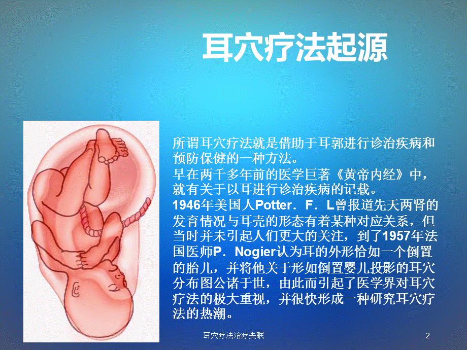 耳穴疗法治疗失眠课件.ppt_第2页