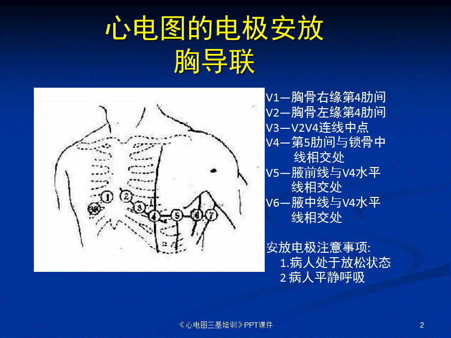 《心电图三基培训》PPT课件课件.ppt_第2页