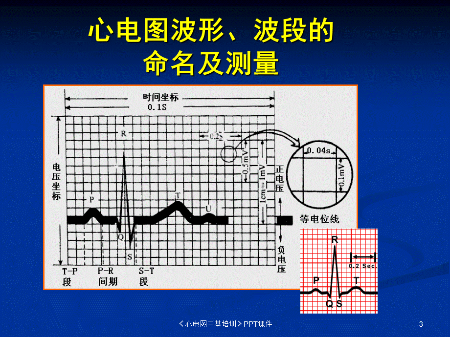 《心电图三基培训》PPT课件课件.ppt_第3页