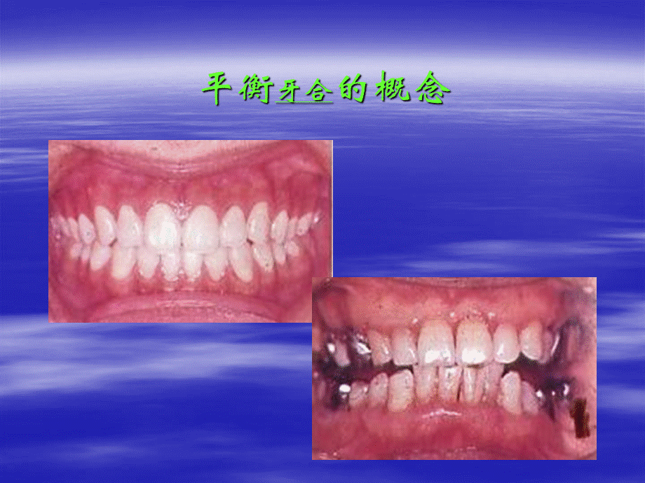 平衡牙合对全口义齿稳定的影响及其临床意义分解.ppt_第3页