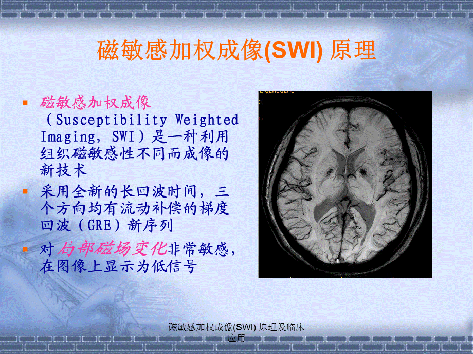 磁敏感加权成像(SWI) 原理及临床应用（经典实用）.ppt_第3页