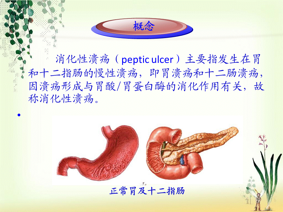 一份消化性溃疡胃镜下表现及护理详解.ppt_第3页