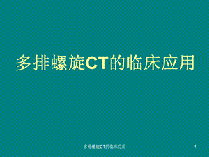 多排螺旋CT的临床应用课件.ppt