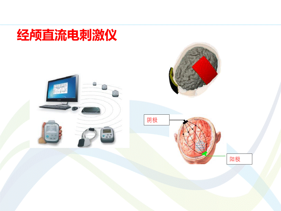 tdcs临床使用方法.ppt_第3页