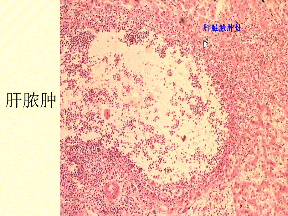 病理切片考试--最完整版PPT课件02.ppt_第3页