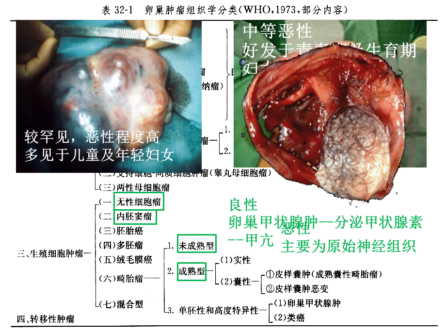 卵巢癌NCCN的解读.ppt_第3页