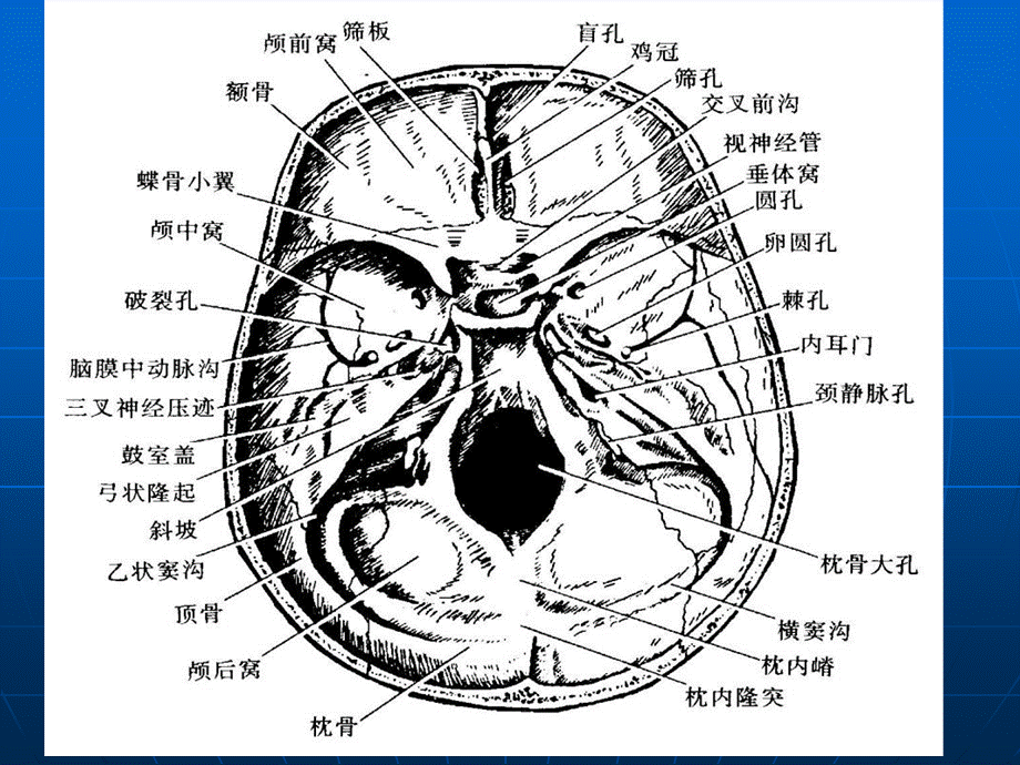 断层解剖学-蝶鞍区.ppt_第3页