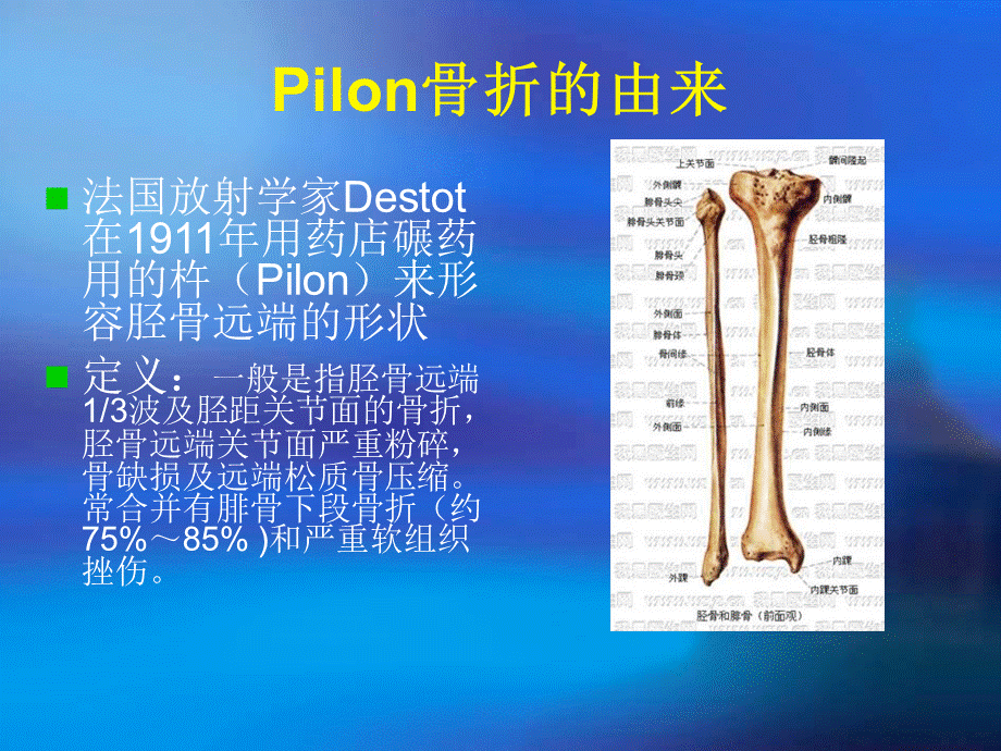 Pilon骨折分型与治疗讲义.ppt_第2页