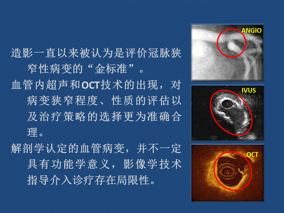 FFR技术的临床应用.ppt_第2页