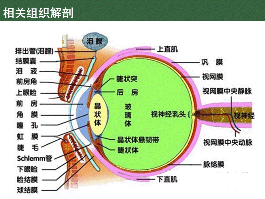 糖尿病视网膜病变简介.ppt_第3页