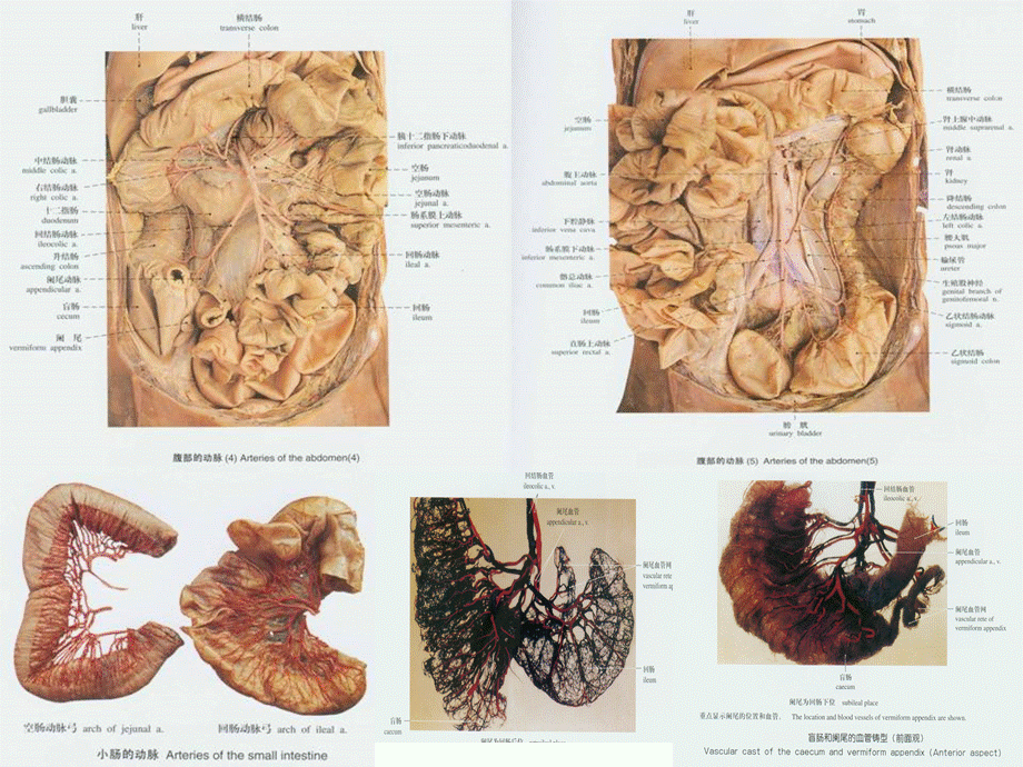 动脉2人体解剖学教学[1]课件.ppt_第3页