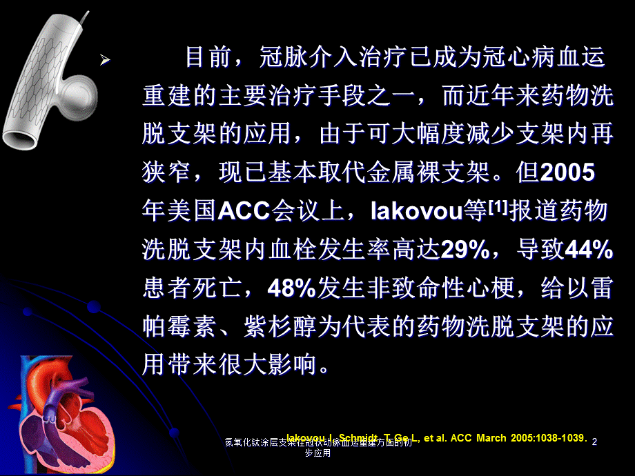 氮氧化钛涂层支架在冠状动脉血运重建方面的初步应用课件.ppt_第2页