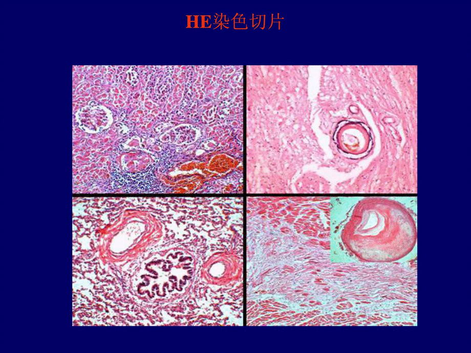 法医病理学组织切片制作[精彩课件.ppt_第2页