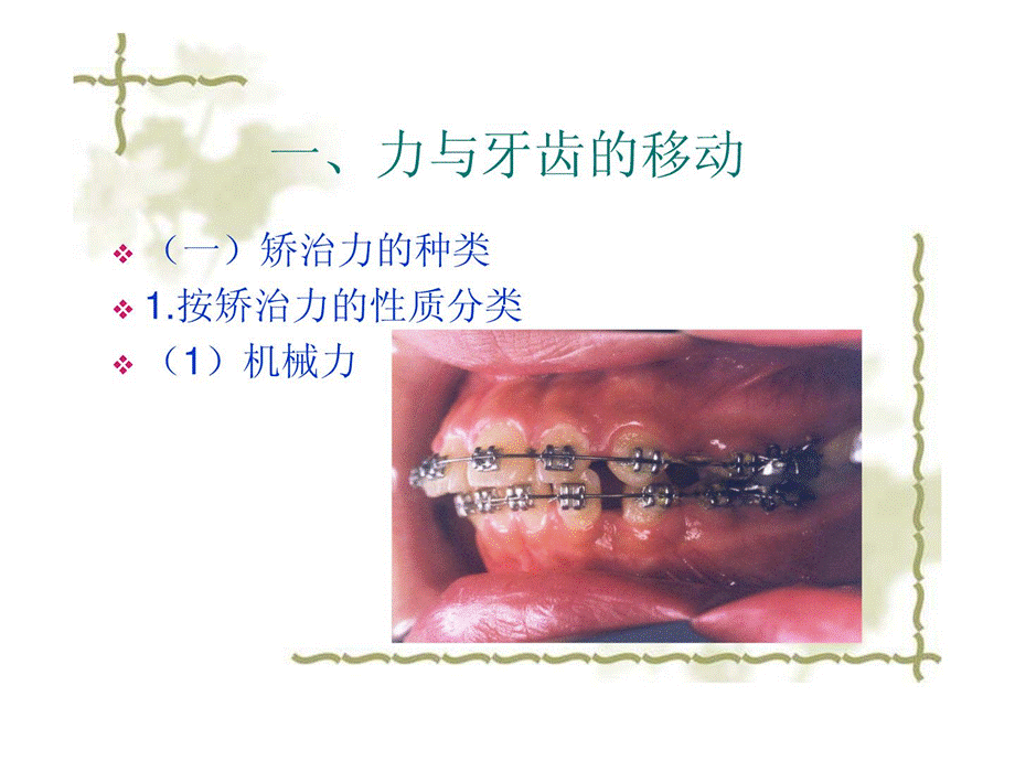 口腔正畸学正畸治疗的生物机械道理课件.ppt_第2页